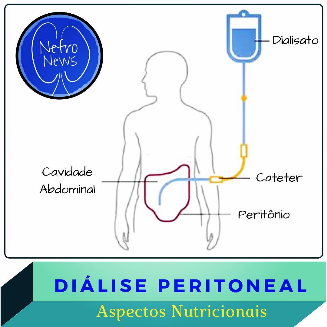 DIÁLISE PERITONEAL