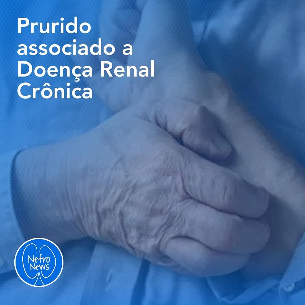 PRURIDO ASSOCIADO A DOENÇA RENAL CRÔNICA